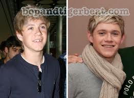 Niall Horan-7